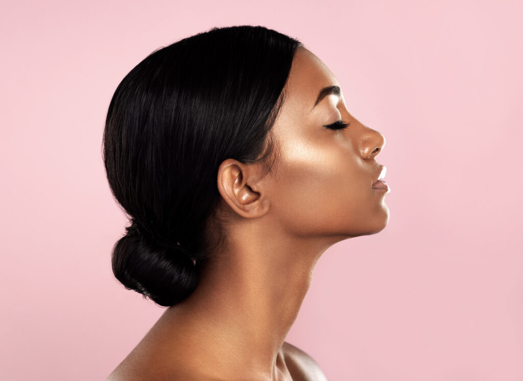 A profile shot of a woman with a defined jawline from Radiesse