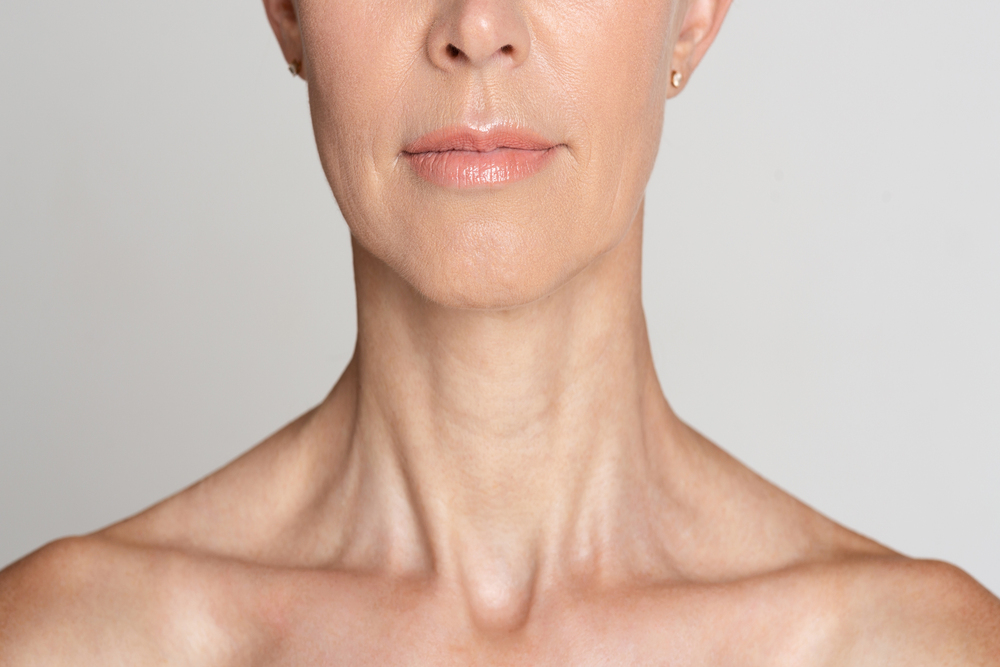A cropped shot of a woman's neck after a neck lift in Raleigh, NC