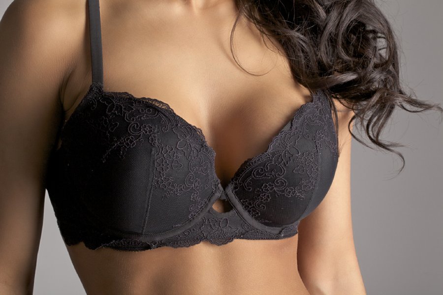 Woman showing a slimmer, more proportional figure after breast reduction surgery.