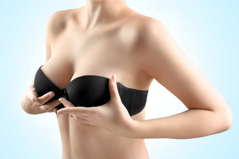 Raleigh NC Breast Lift with Augmentation