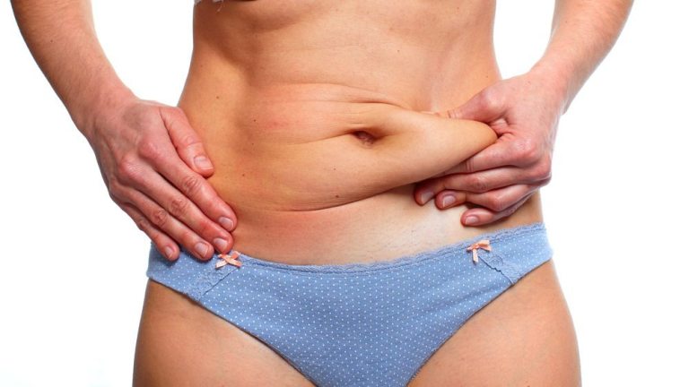 mini tummy tuck raleigh