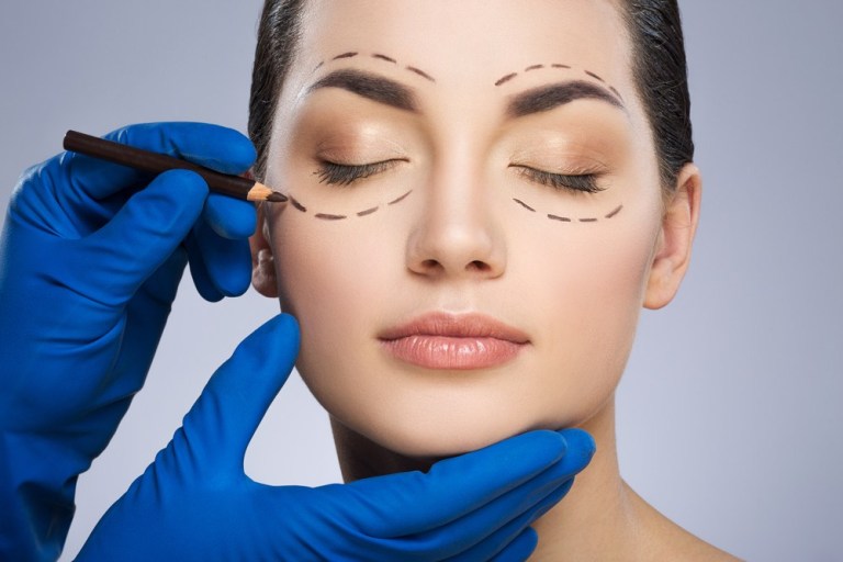 eyelid surgery raleigh