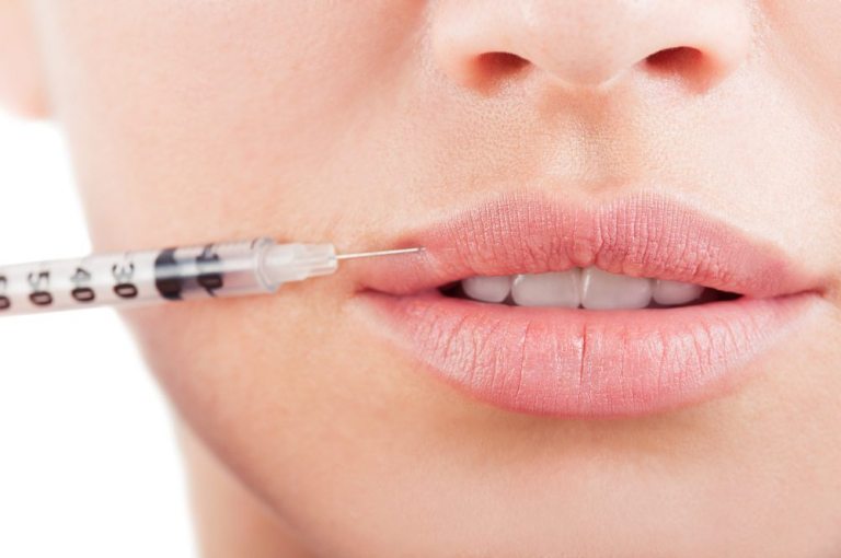 Lip Augmentation | Allen Aesthetic Surgery