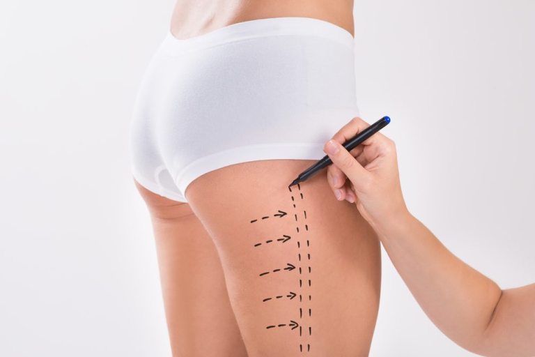 7 Aftercare Tips for Thigh Lift Surgery - Harley Clinic